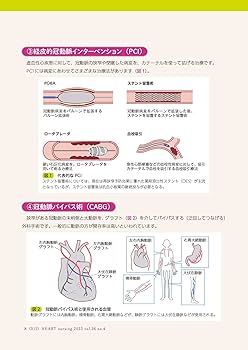 ナーシングプラン集 上巻: はじめてのケースでも困らない 疾患別・症状別・治療処置別 消化器ナーシング 2023年3月号 これだけチェック！ 消化器内視鏡